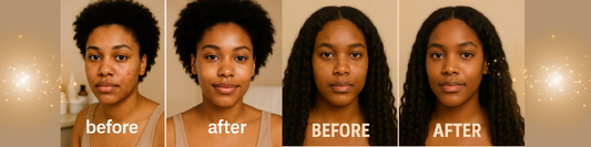 Why Black Women Deserve Clean Skincare: A Real Conversation About What’s in Our Products